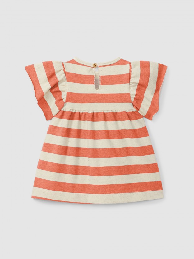 Striped dress Striped dress